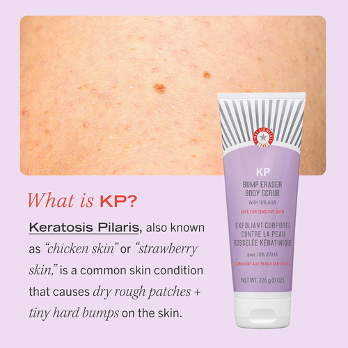 - KP Bump Eraser Body Scrub with 10% AHA, Keratosis Pilaris Skin Exfoliator with - Picture 6 of 12