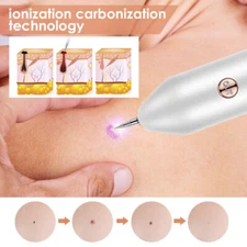 Skin Spot Remover Pen Mole Freckle Removal USB Device Winter Facial Hand Body