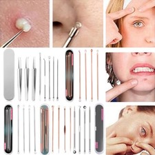 4pcs Acne Extractor Remover Blackhead Pimple Needle Spot Comedone Popper Tool  