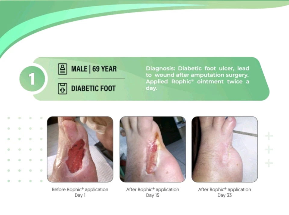 Rophic 软膏 – 皮肤溃疡、烧伤、瘙痒、伤口和湿疹缓解 – 快速愈合 — 第 2/4 张图片