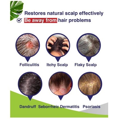 Scalp Psoriasis Treatment - Soothing Shampoo=