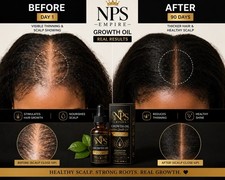 Hair Growth Oil Herbal Hair Loss Treatment Hair Growth Serum for Men Women 30ml