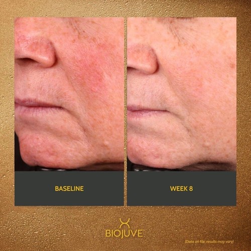 BIOJUVE Hydrating Barrier Cream Normal to Oily Skin 1.69oz AUTHENTIC FRESH $75 - Picture 5 of 5