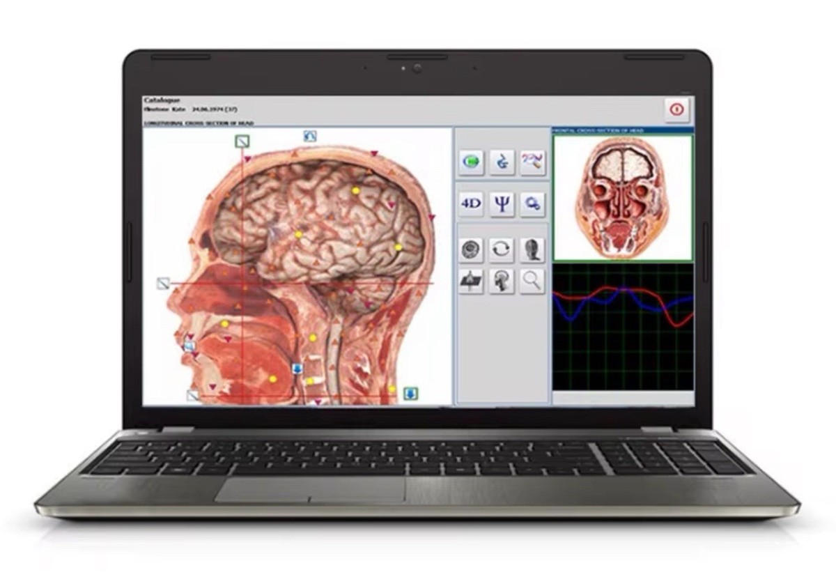 Meta Hunter 4025 advanced non-linear analysis system provides