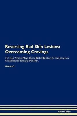 Reversing Red Skin Lesions, Health Central,  Paper