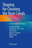 Shaping For Cleaning The Root Canals Gustavo De Deus
