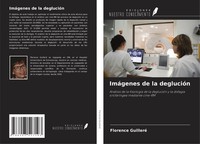 ImáGenes De La DeglucióN Florence Guilleré
