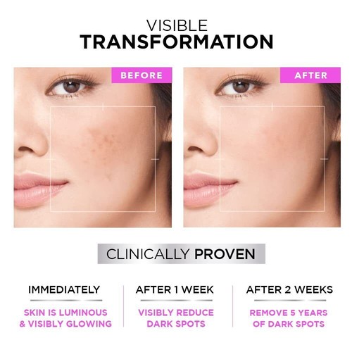 Limpiador facial espumoso diario brillante glicólico L'Oréal Paris, 50 ml - Imagen 2 de 4