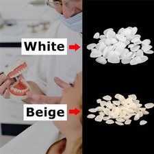 50-100 Dental Teeth Veneers Thin Whitening Resin Anterior Upper Temporary Crown