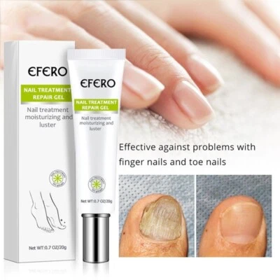 EFERO Nail Anti Fungal Infection Gel Treatment Hand Foot Cream Toenail Remover