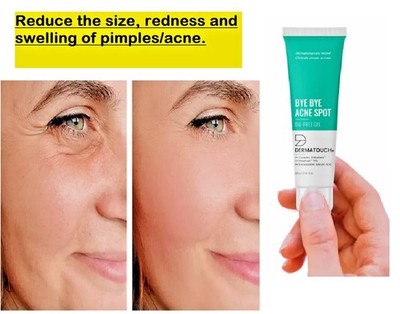 Dermatouch Anti-Acne Oil-Free Gel For Active Acne Pore Tightening - 30Gm