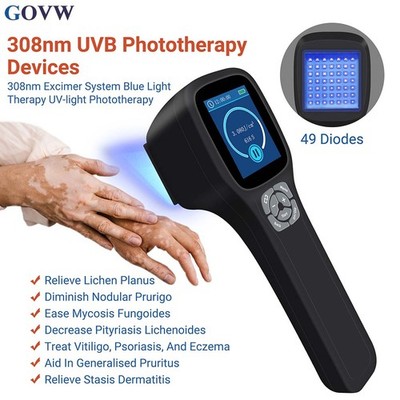 308nm Narrowband UVB Therapy Device Home Use Phototherapy Lamp for Skin Repair
