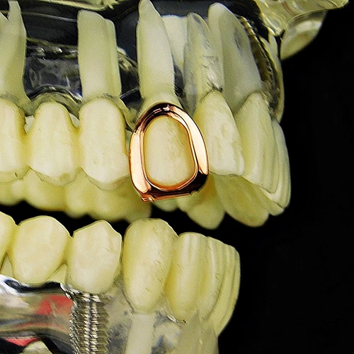 وجه مفتوح 14k مطلية بالذهب الوردي Grillz غطاء واحد مجوف واحد أعلى شوايات الأسنان