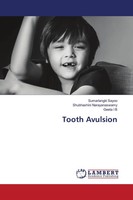 Sumarlangki Sayoo (U. A.) | Tooth Avulsion | Taschenbuch | Englisch (2020)