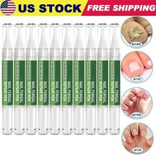 Anti Fungal Treatment Extra Strength Toenail Fungus Foot Nail Repair Pen -20 OFF