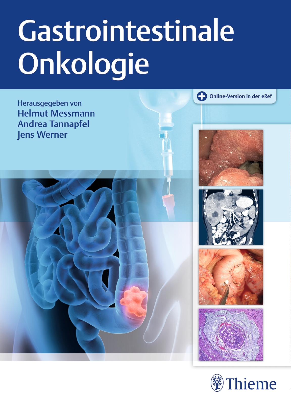 Gastrointestinale Onkologie Helmut Messmann