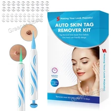 Natural Painless Auto SKIN TAG Removal Kit Skin Tag Bands Remover Device Auto