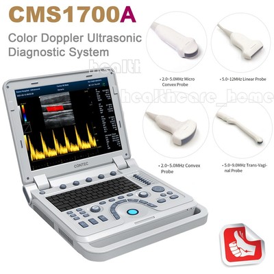 CONTEC NEW Color Doppler Ultrasound Scanner Portable Laptop Machine,CF,PDI,PW