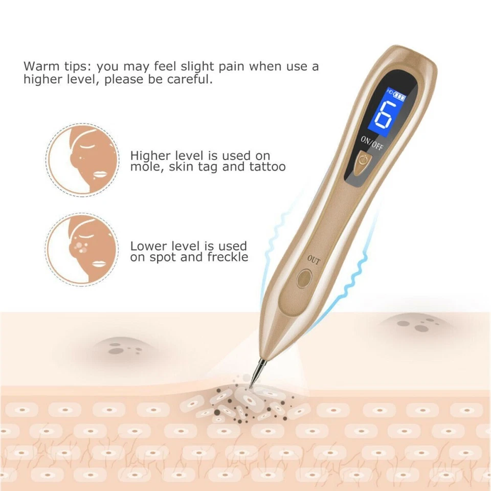 Laser Plasma Pen Skin Tag Mole Freckle Removal Dark Spot Tattoo Wart Remover Pen - Image 4 of 4