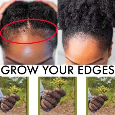 Chebe Hair Growth Shampoo   Ancient African Formula for Fast Hair Loss Treatment