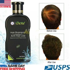 200ml Dexe Original Anti Hair Loss Shampoo Natural Herbal Hair Growth Treatment