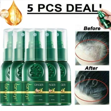 5/3PCS HyunGang Korea Ginseng Hair Regrowth Serum Spray Ginger Hair Growth Spray