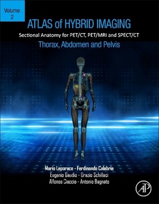 Atlas der hybriden Bildgebung Schnittanatomie für PET/CT, PET/MRT... - 9780443187339