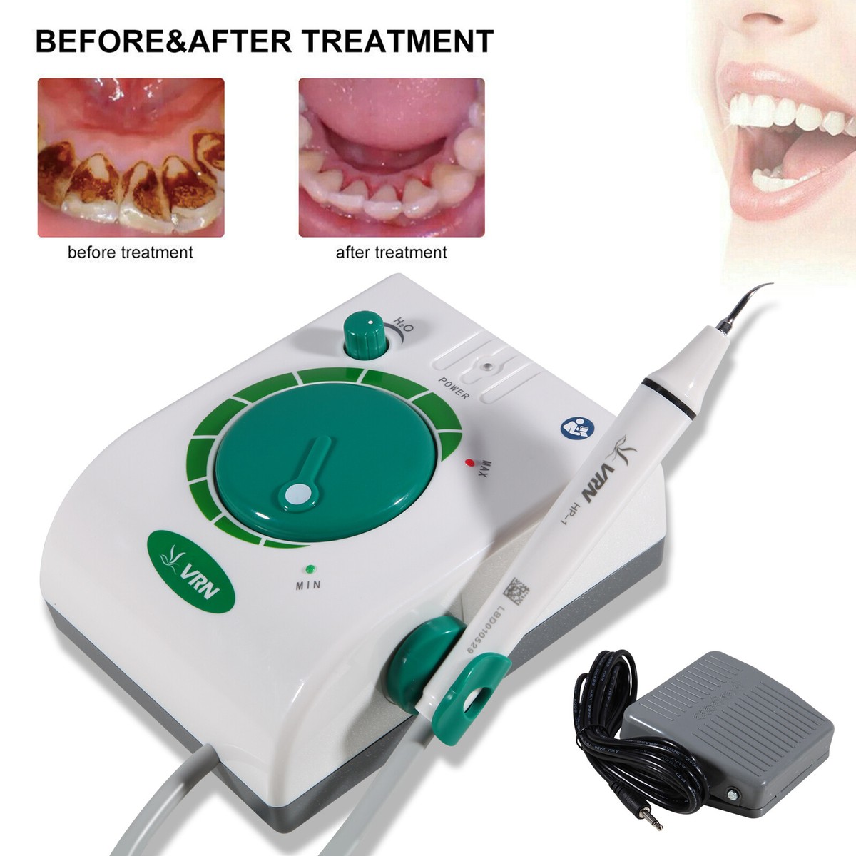 Ultrasonic Dental Piezo Scaler Equipment with 5 Tips Fit Cavitron EMS Handpiece