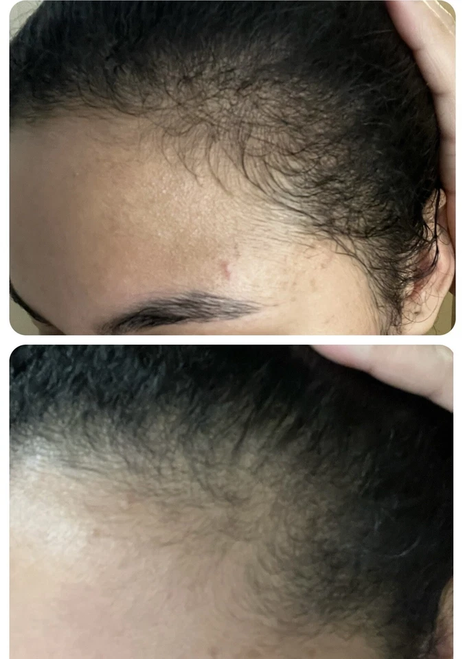 Gotero/tónico capilar control caída y crecimiento - Image 4 of 4