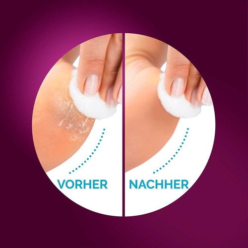 Scholl Velvet Smooth Wet Dry Lima Elettrica per Piedi Blu - Foto 6 di 7