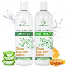 Anti-Dandruff  Seborrheic Dermatitis Treatment Shampoo  Conditioner Set for...