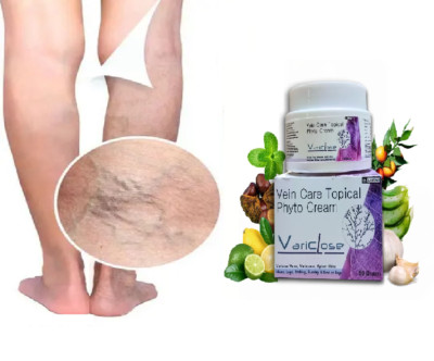Varicose Veins Cream Multi Use Ayurvedic Topical Gel For Better Vein Flow