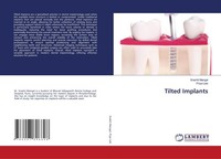 Tilted Implants Priya Lele