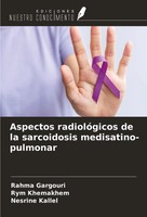 Rahma Gargouri (U. A.) | Aspectos RadiolóGicos De La Sarcoidosis...