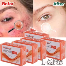 Kojic Acid Soap Dark Spot Whitening Turmeric Soap Skin Bleaching Lightening 100G