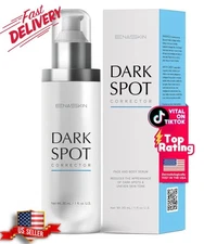 Dark Spot Remover Face & Body Serum: Age Spot Sun Spot Freckles Melasma Brown...