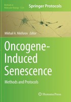 Mikhail A. Nikiforov | Oncogene-Induced Senescence | Taschenbuch | Englisch | Xi