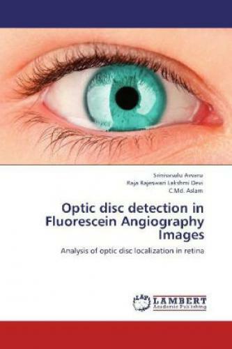 Thumbnail - Optic Disc Detection In Fluorescein Angiography Images Analysis Of