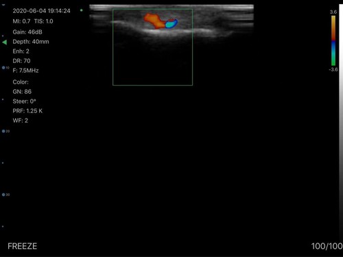 Wifi Color Doppler 128 Elemente 3 in 1 Konvex/Linear/Herzunterstützung Android iOS - Bild 12 von 15