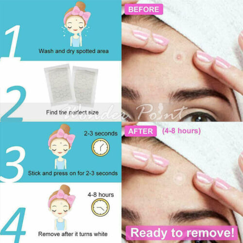 36pcs Acne Dots Pimple Patches Cystic Acne Patch Hydrocolloid Acne Spot Sticker - Picture 3 of 12