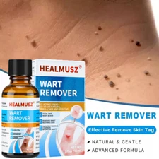 HEALMUSZ Wart Remover Liquid Plantar Wart Removers for Feet Body Fast Acting