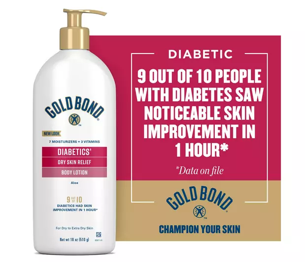 Gold Bond Diabetics Dry Skin Relief Body Lotion 18 oz. with Aloe