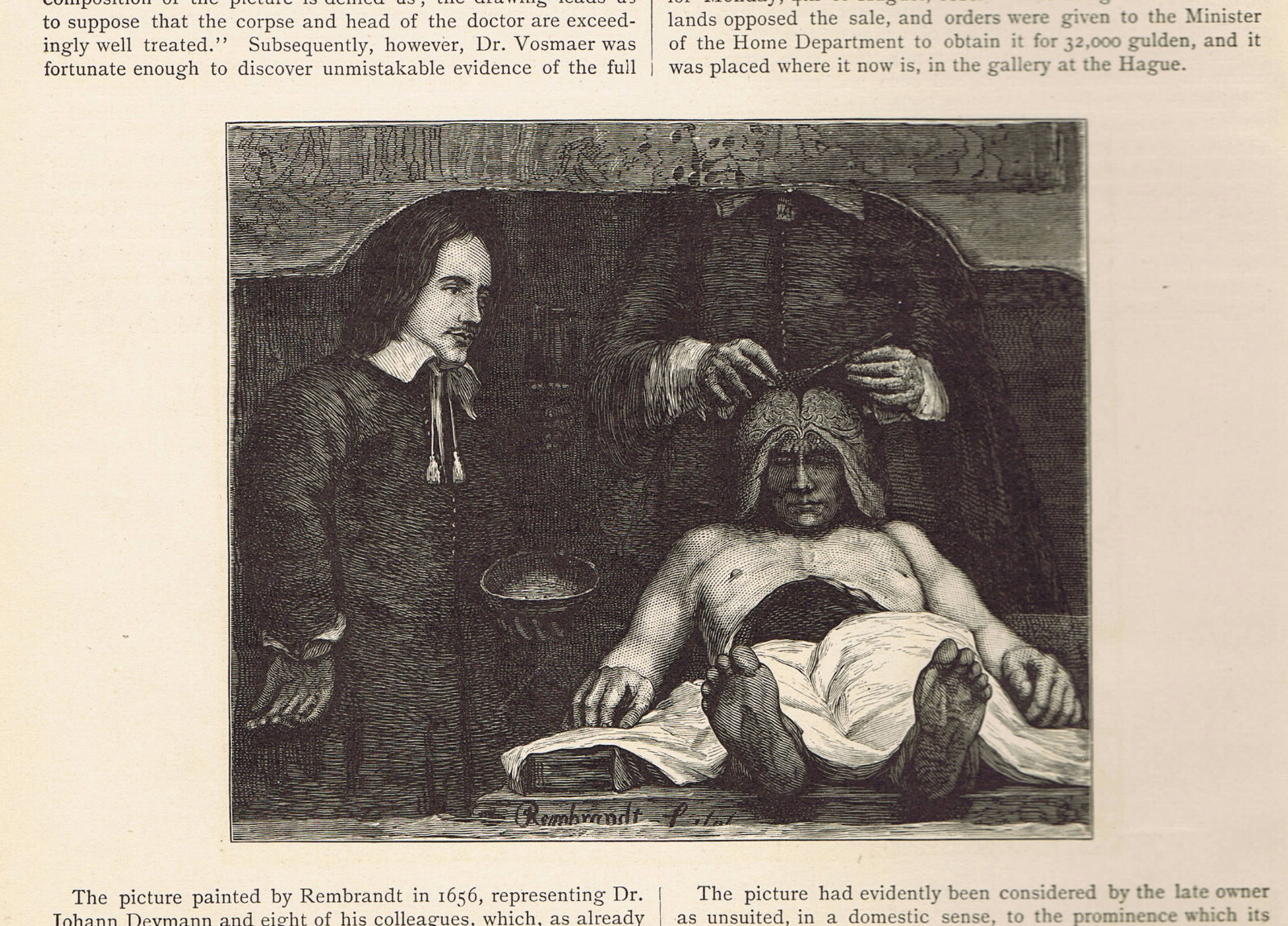 Rembrandt Anatomy Lesson Of Dr Deyman