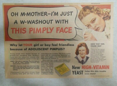 Fleischmann's Yeast Ad: I'm A Washout With This Pimply Face ! from1930's