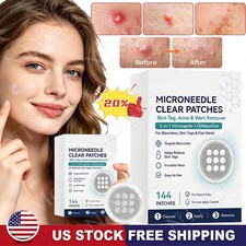 2026 NEW Curalona Microneedle Patches 144pcs, Skin Tag Wart Acne Remover Patches