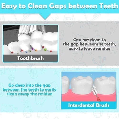 30Pcs Dental Orthodontics Brace Interdental Brush Clean Between Teeth Toothbrush - Image 4 of 4