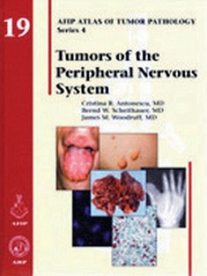 Tumors of the Peripheral Nervous System by Cristina R. Antonescu (English) Hardc