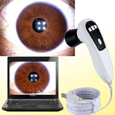 Best 5.0 MP 4 LED/2 LED USB Eye Iriscope Iridology Camera w/PRO Software CE-Hot