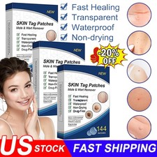720PCS Skin Tag Remover Patches Quick Effective Mole Wart Removal Pad Sticker
