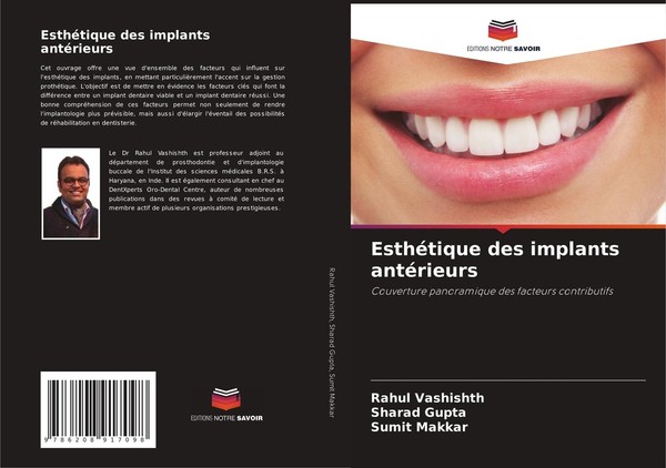 EsthéTique Des Implants AntéRieurs Rahul Vashishth-image
